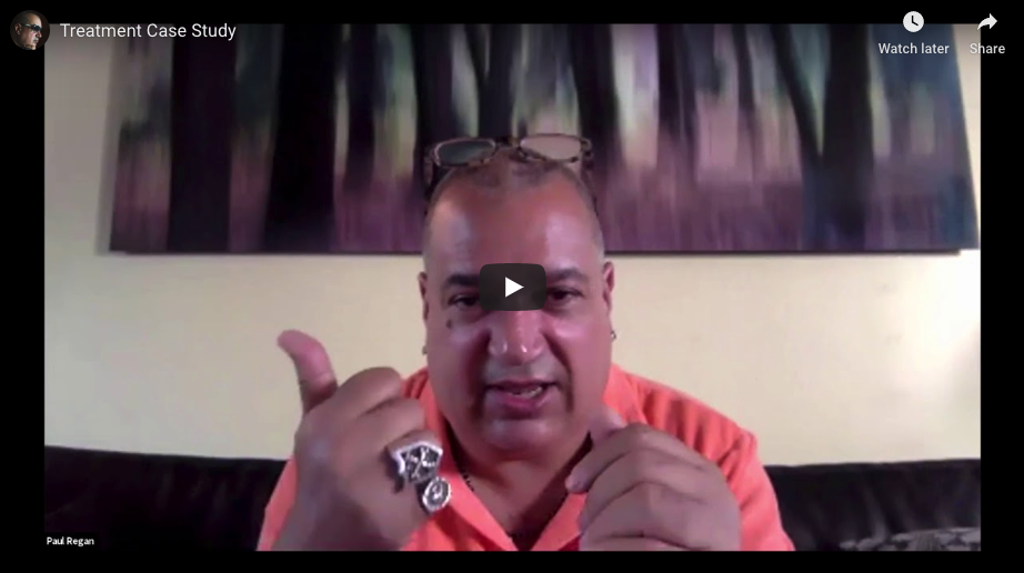 Director treatment case study